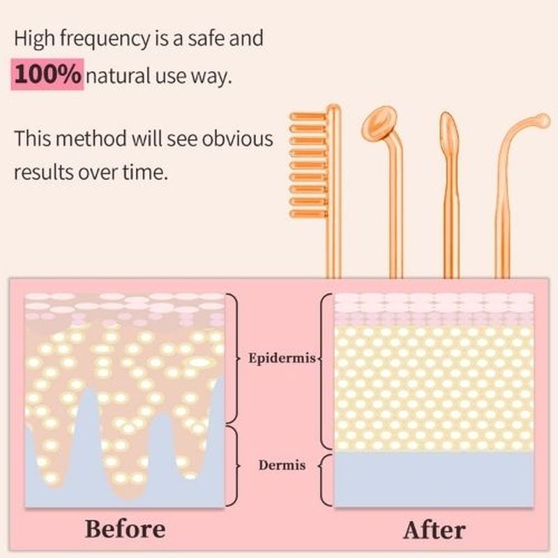 4 in 1 Facial Electrotherapy Wand