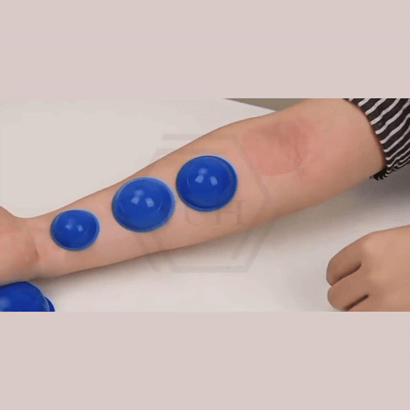 The Complete Cupping Therapy Kit